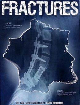 Fractures (2017)